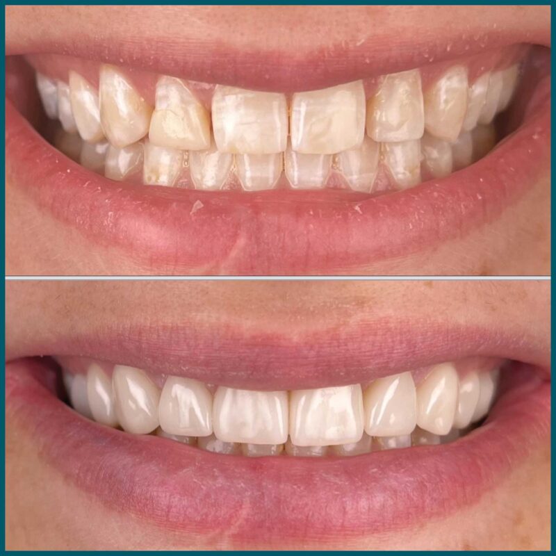 Day One Dentistry Before and After Photo 3